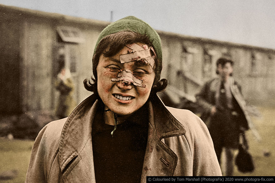 One of the victims at Bergen-Belsen was this young woman, her face still bearing the scars of a terrible beating by the SS guards. The military ALWAYS censors the images of war to prevent the troops from getting “soft” towards the “enemy”.