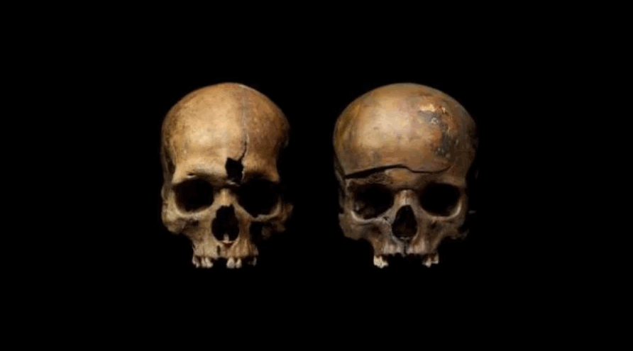Skulls  from the mass grave in Yaroslavl show signs of extreme violence.