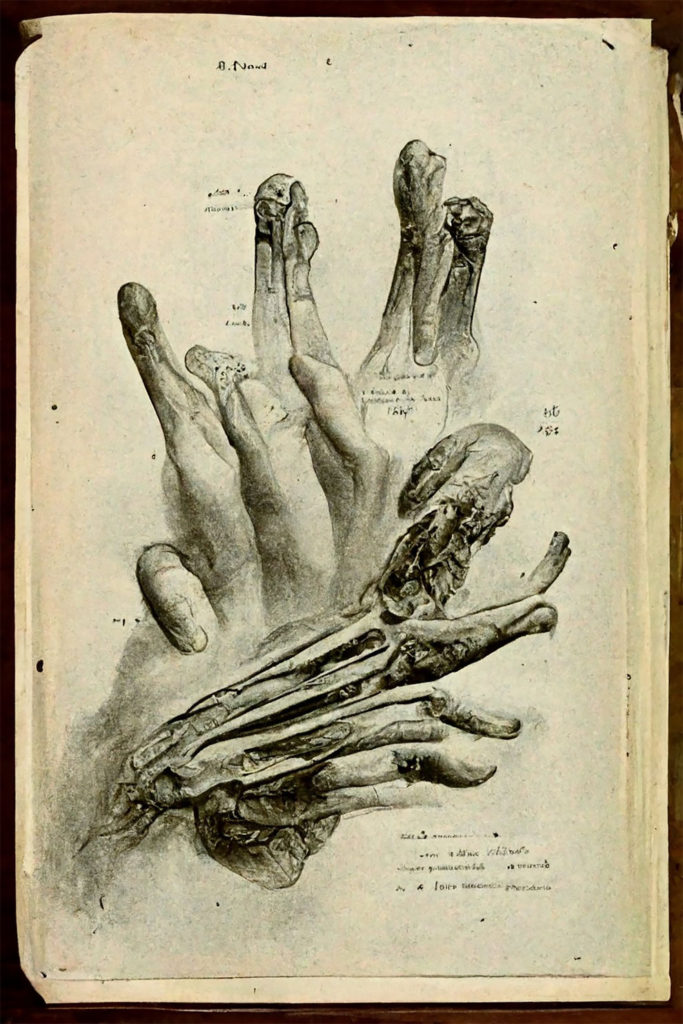 Stunning and disturbing "hands" 1