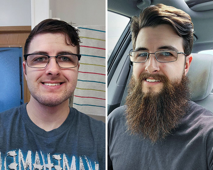 before after beard growing pics 110 6458b2a821cac 700