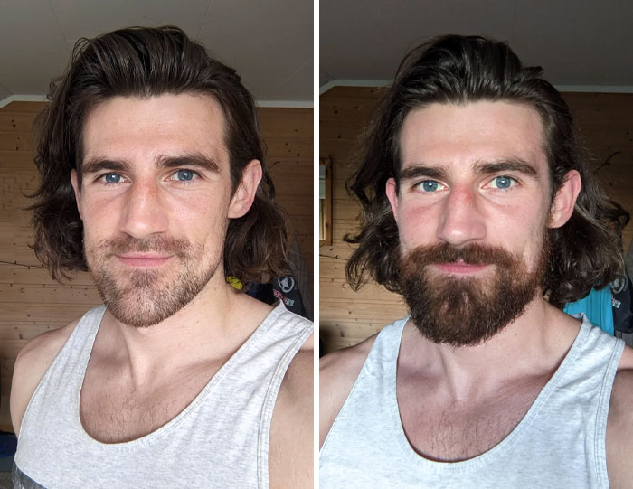 before after beard growing pics 30 6451149edcdc7 700