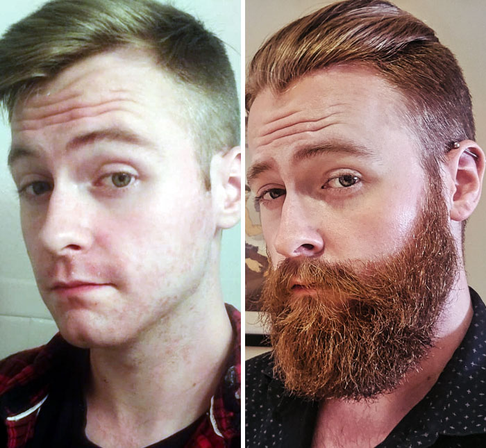 before after beard growing pics 35 645115d195523 700