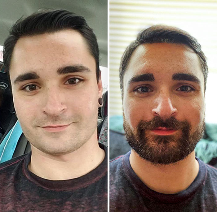 before after beard growing pics 47 645131092dc14 700