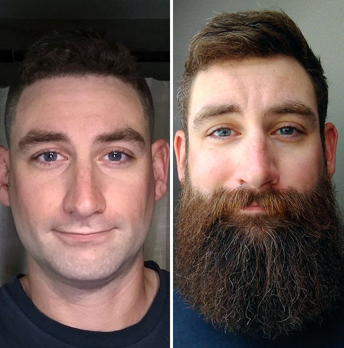 before after beard growing pics 66 645211814649b 700