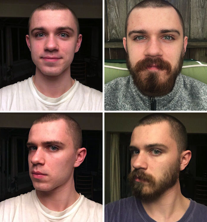 before after beard growing pics 79 6458f9f555f07 700