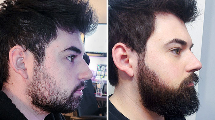 before after beard growing pics 95 6458c49b31a94 700