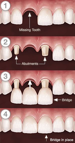 6e0f613c529523d2c7836cfe7e55d8c5