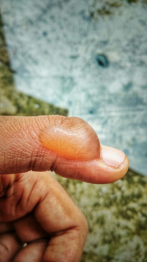 e2c431b3a337717c520eb7009661c15c